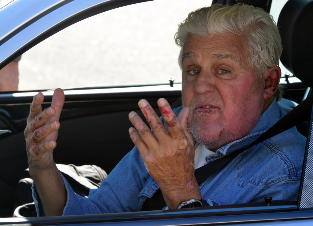 jay leno with burns