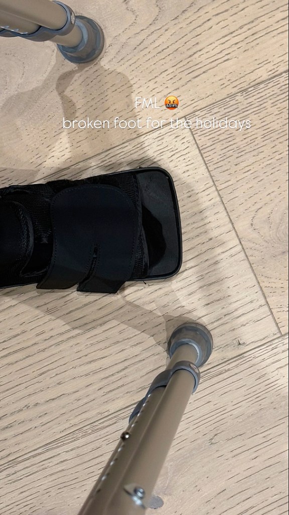 Kim Kardashian's broken foot