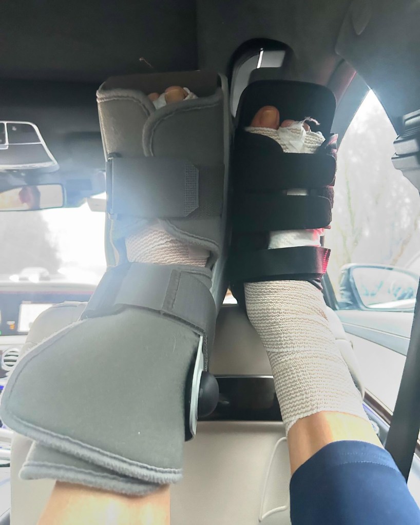 Lara Spencer feet post-surgery