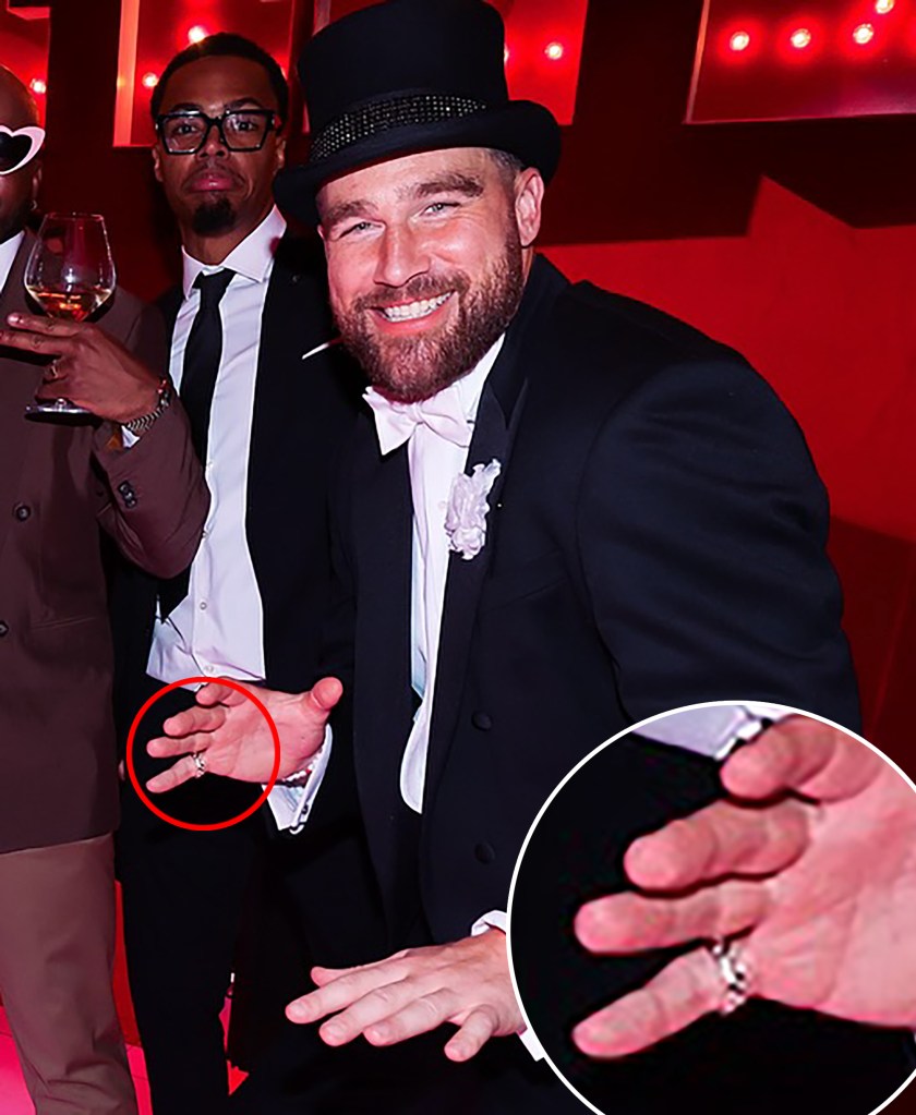 travis kelce pinky ring