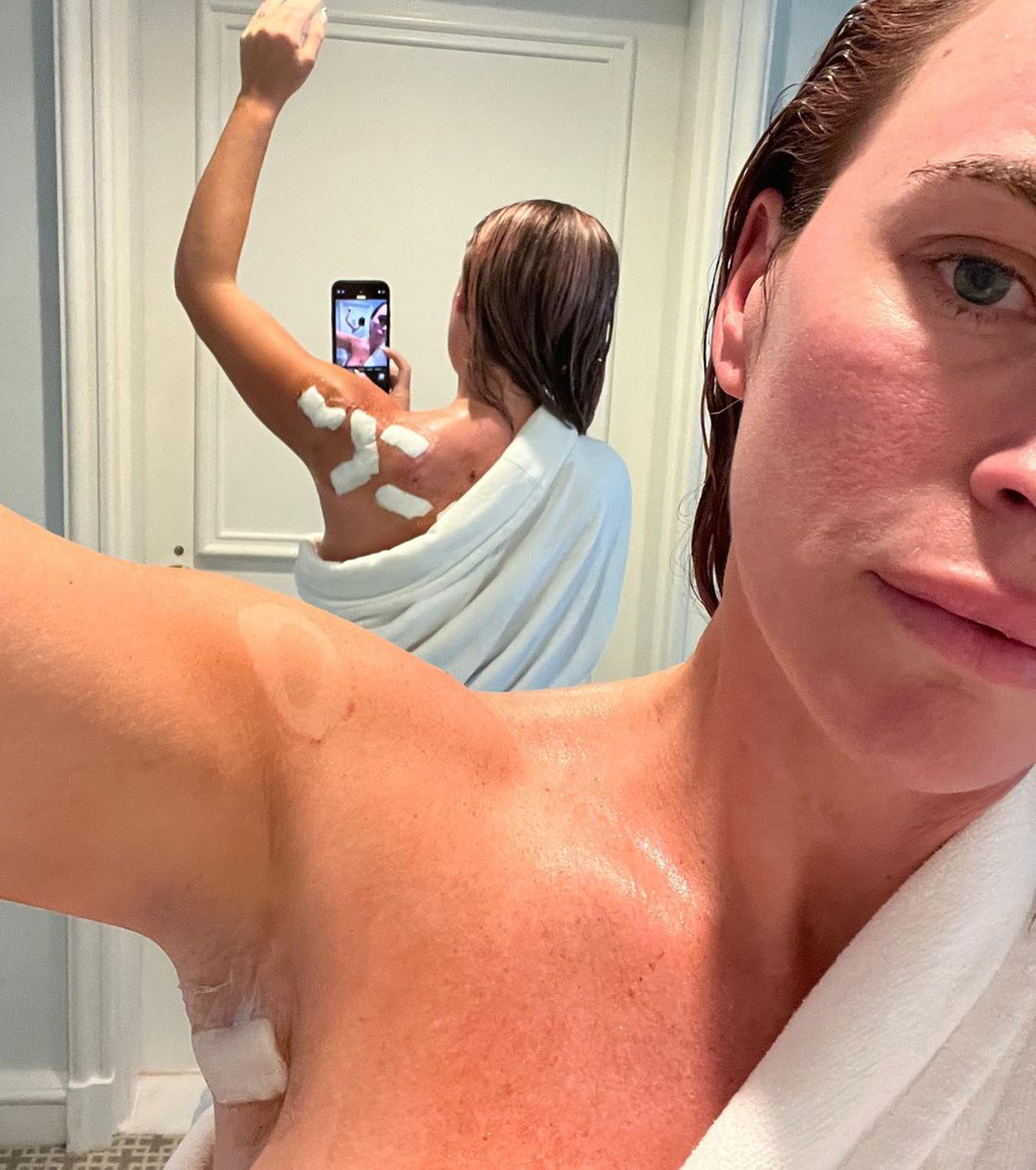 Teddi Mellencamp taking a selfie with bandages on her back